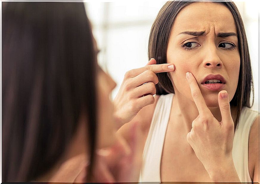 Acne pimples: habits to reduce their appearance