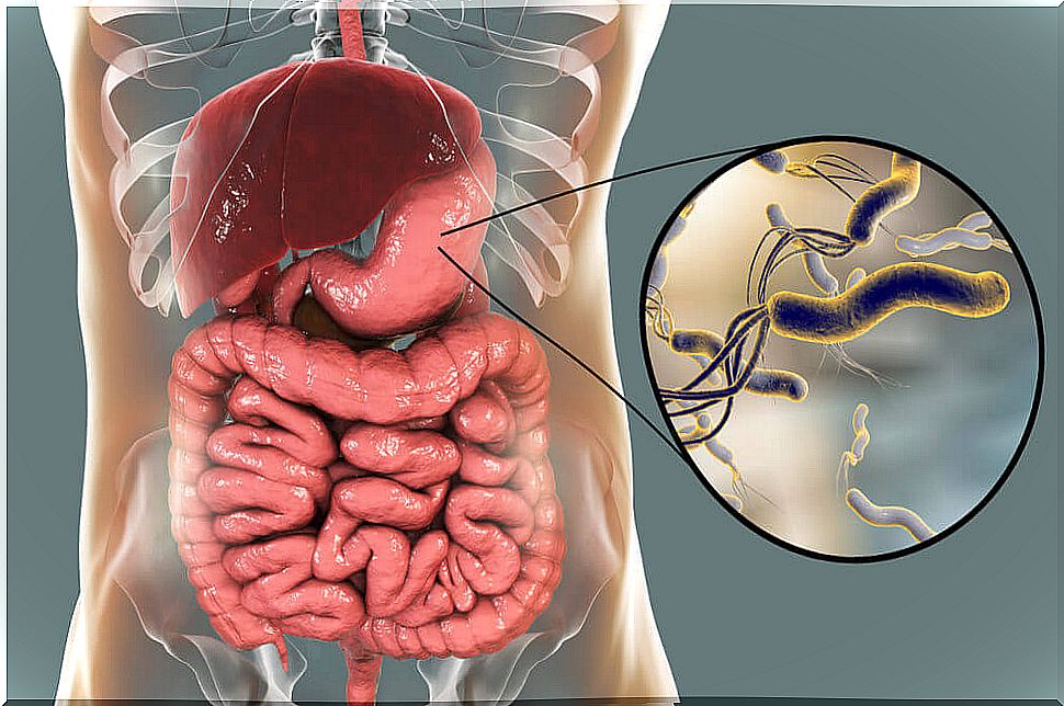 Helicobacter pylori is the bacteria that can attack the stomach.