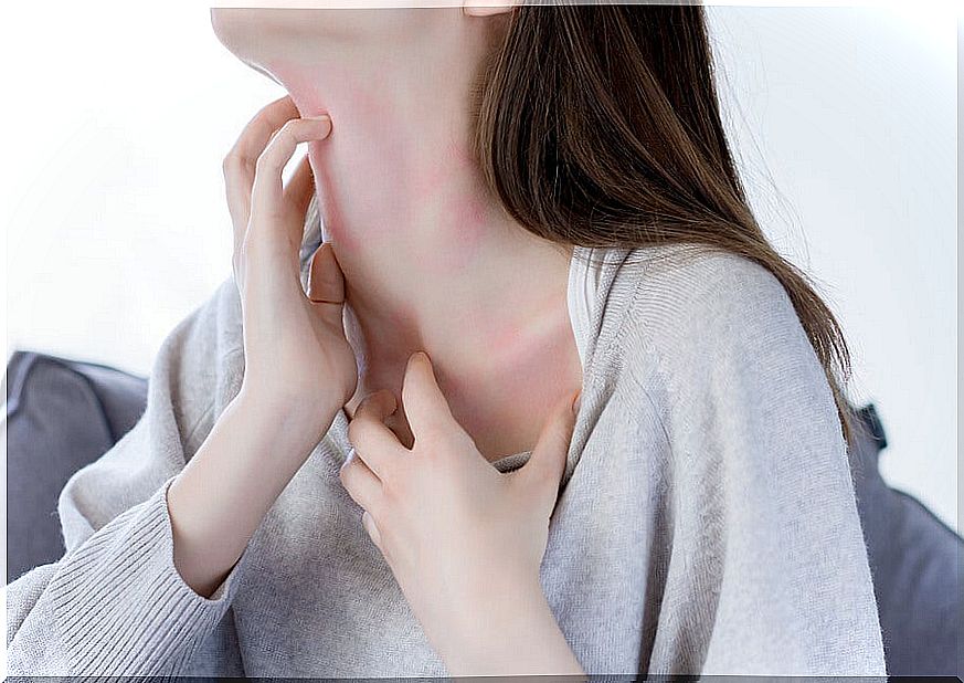 Appearance of hives or rashes