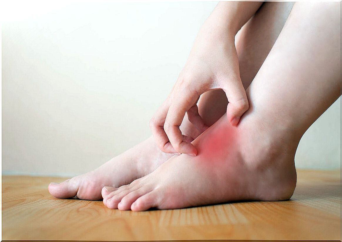 Edema in the feet with pain